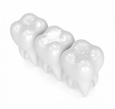 Treatment - Fillings