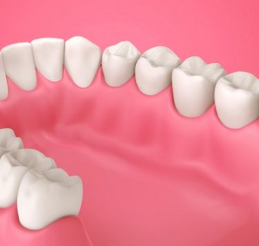 Treatment - Periodontics — The Health of Your Gums