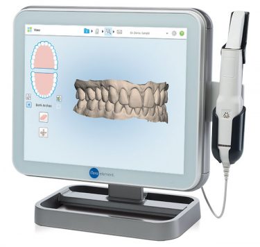 Treatment - Digital Impressions – iTero Scanner